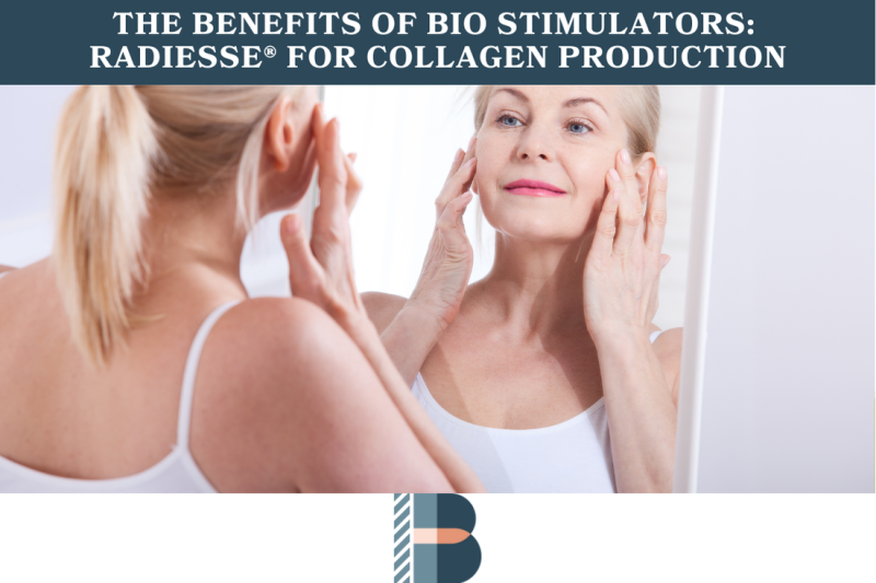 The Benefits of Bio Stimulators RADIESSE® for Collagen Production