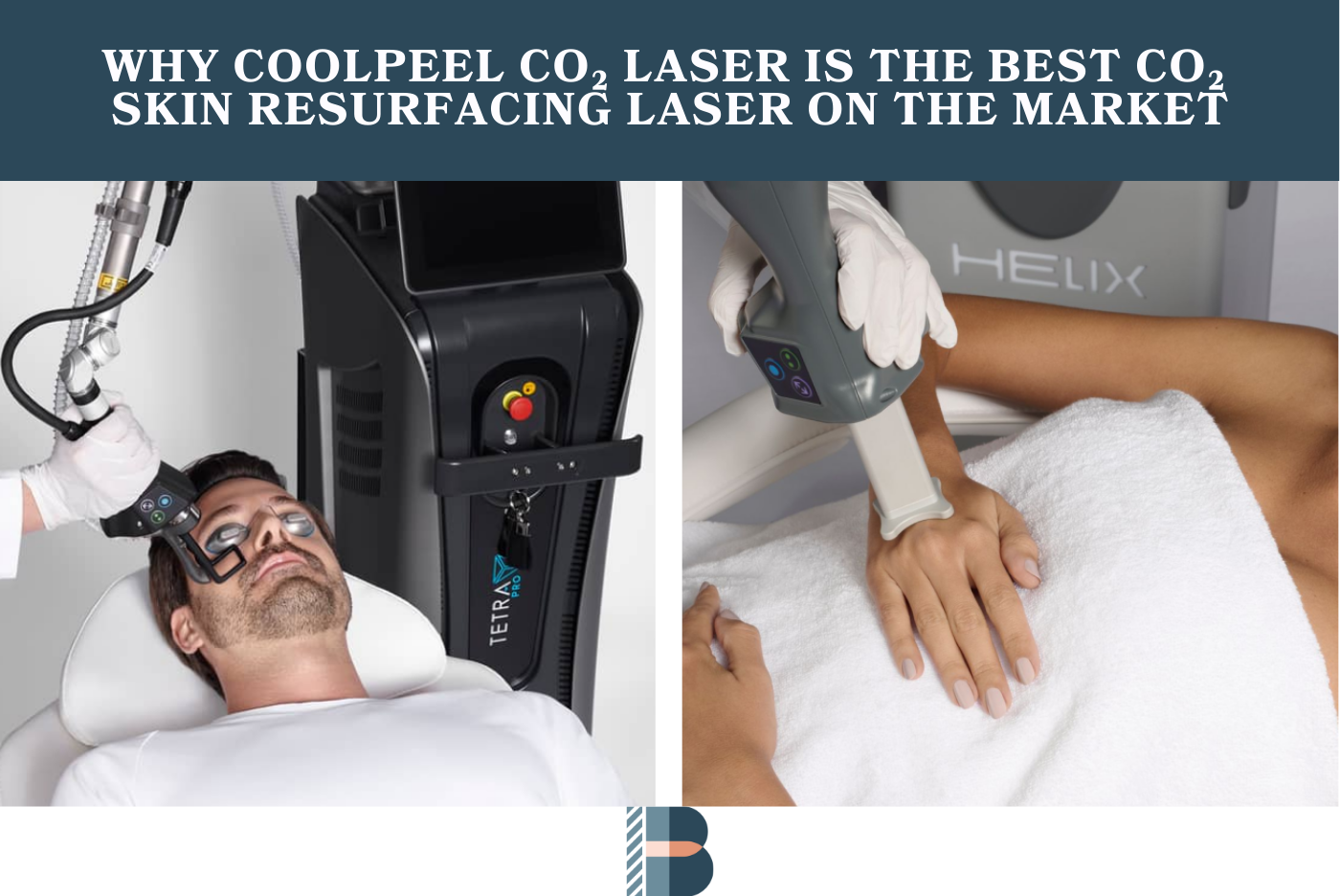 Why CoolPeel CO₂ Laser Is the Best CO₂ Skin Resurfacing Laser on the Market