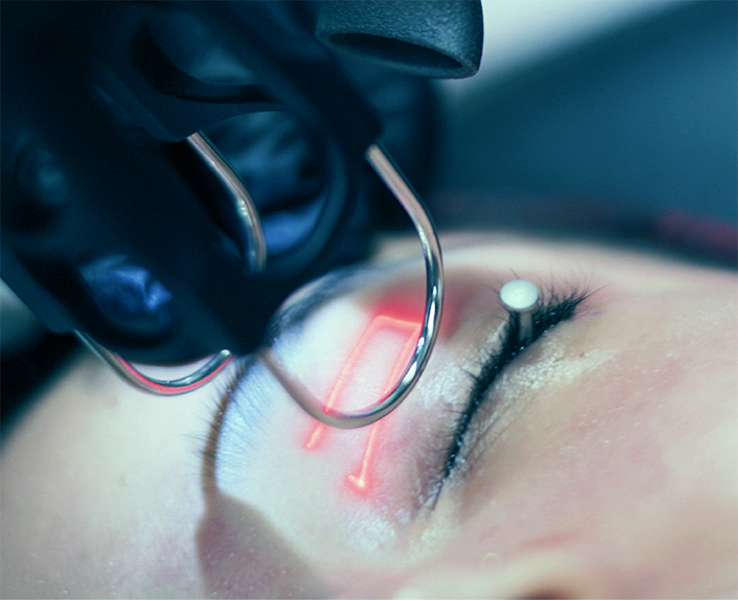 CoolPeel CO2 laser resurfacing in Jericho NY at Bespoke Medesthetics